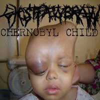 chernobyl_child_200
