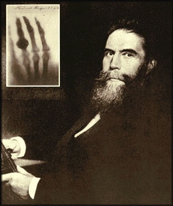 roentgen