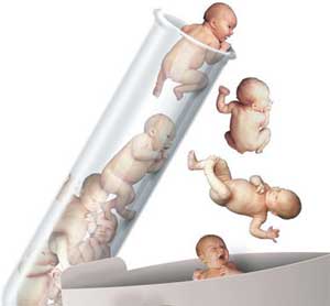 Test Tube Babies