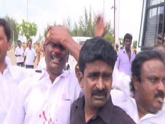 police attack 330