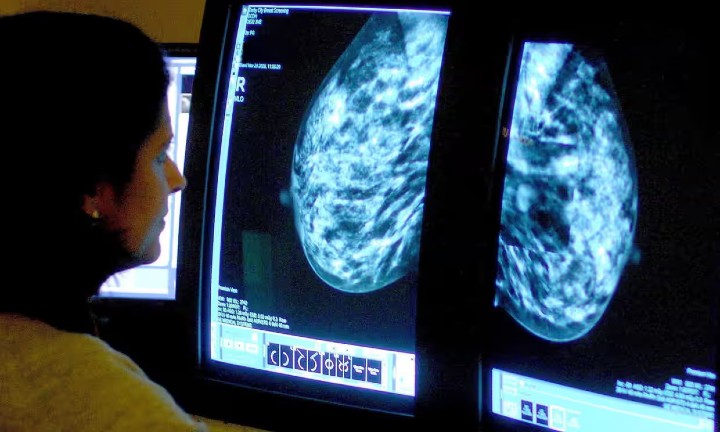 mammogram