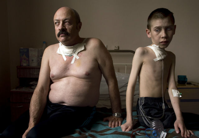 chernobyl_victims_638